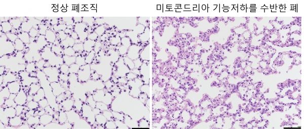미토콘드리아 기능 저하에 따른 쥐의 폐조직 변화미토콘드리아 기능저하를 가진 쥐의 폐조직은 비정상적인 상태의 폐포조직을 형성하고 있는 것을 확인하였다.그림설명 및 그림제공 : 노스웨스턴대 한승혜 교수