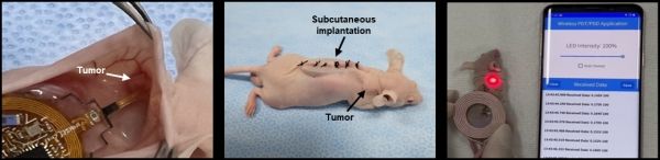완전삽입형 무선 치료기기의 생체 삽입 및 구동 사진. 출처 : 연세대학교
