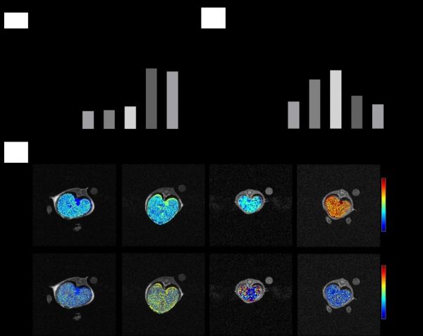이중 입력 유사 3-구획 모델을 이용한 비알콜성 지방간염 진행 모니터링 결과. 출처 : KAIST