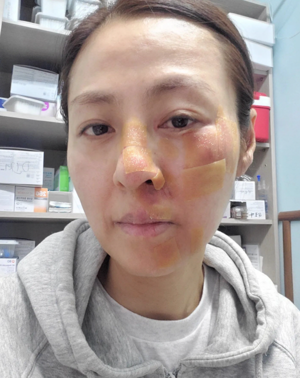 전혜진 인스타그램