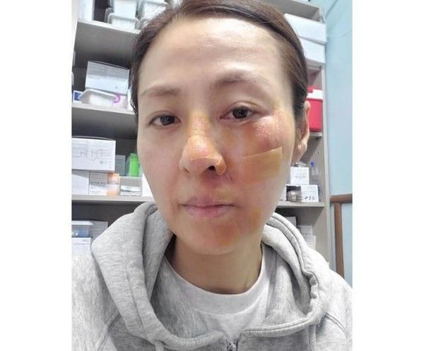 사진=전혜진 인스타그램