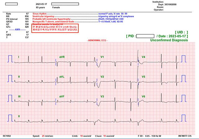 ‘AiTiALVSD’의 분석결과가 병원 전산 화면에 표시된 모습(왼쪽 상단 빨간색 박스) /이미지 제공=메디컬에이아이