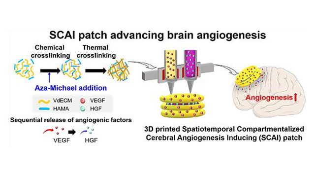 이중 화학적 가교 하이브리드 잉크를 사용한 SCAI 패치 제작 과정 /이미지 제공=서울대병원