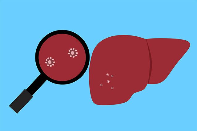 이미지 출처=픽사베이