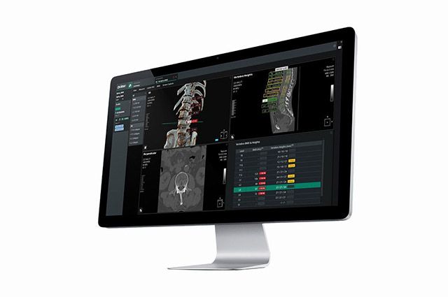SPINE BH /이미지 제공=코어라인소프트