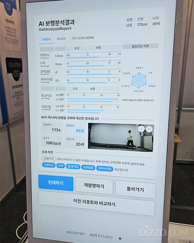 메디스텝의 보행 분석 결과는 종이 출력도 가능하다.