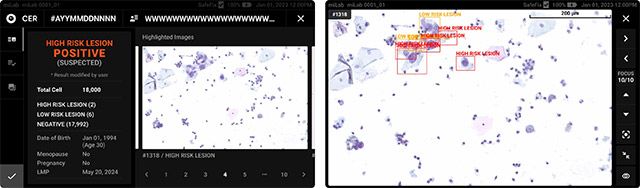 miLabTM CER의 진단 결과 화면 /이미지 제공=노을