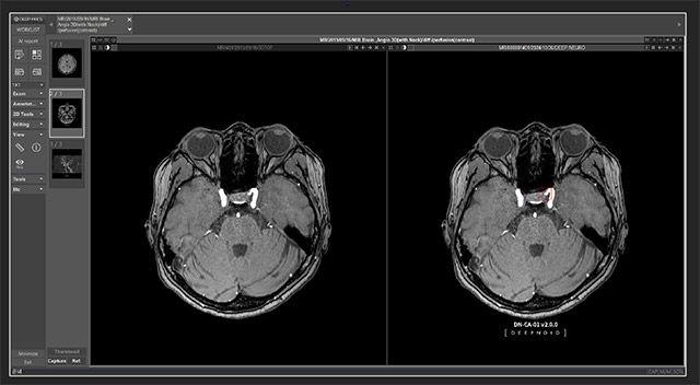 흉부 X-ray 판독에서 M4CXR(연구용)의 사용 예시 /이미지 제공=딥노이드