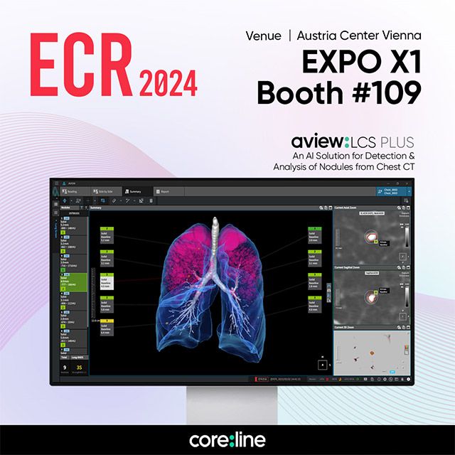 이미지 제공=코어라인소프트