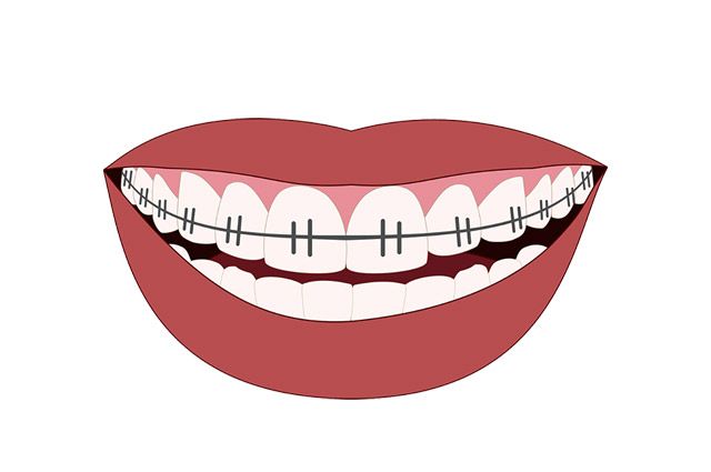 이미지 출처=픽사베이