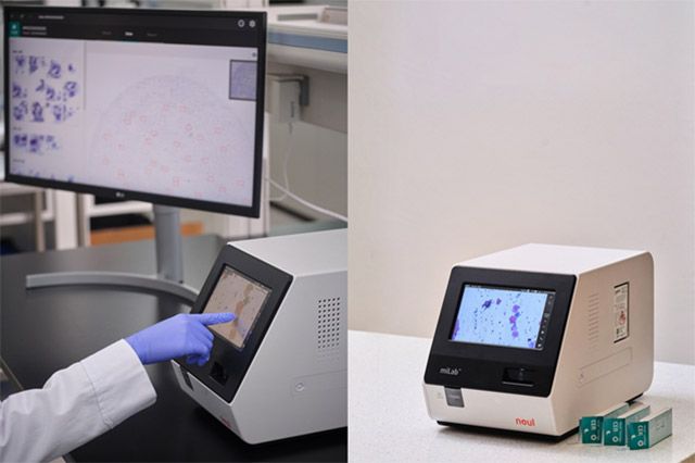 노을 자궁경부세포분석 솔루션 miLab™ CER /이미지 제공=노을