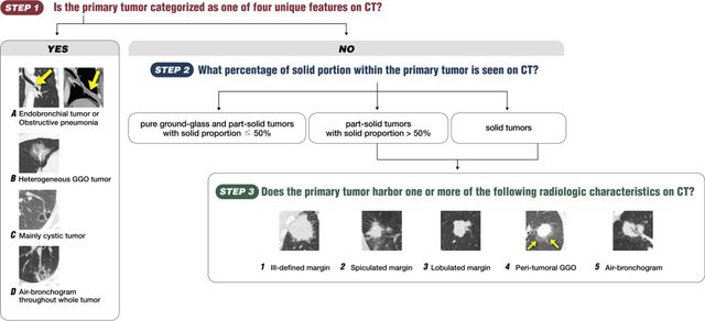 논문에 실린 CT를 이용한 종양의 평가 방법 모식도 /이미지 제공=중앙대학교병원