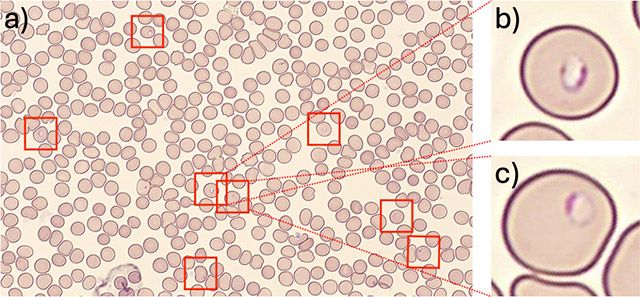 표준 현미경에서 음성으로 판별된 샘플을 miLab™ MAL이 정확히 식별한 모습 /이미지 제공=노을