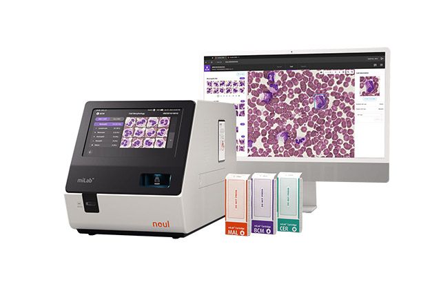 AI 기반 혈액 및 암 진단 솔루션 ‘마이랩’ /이미지 제공=노을