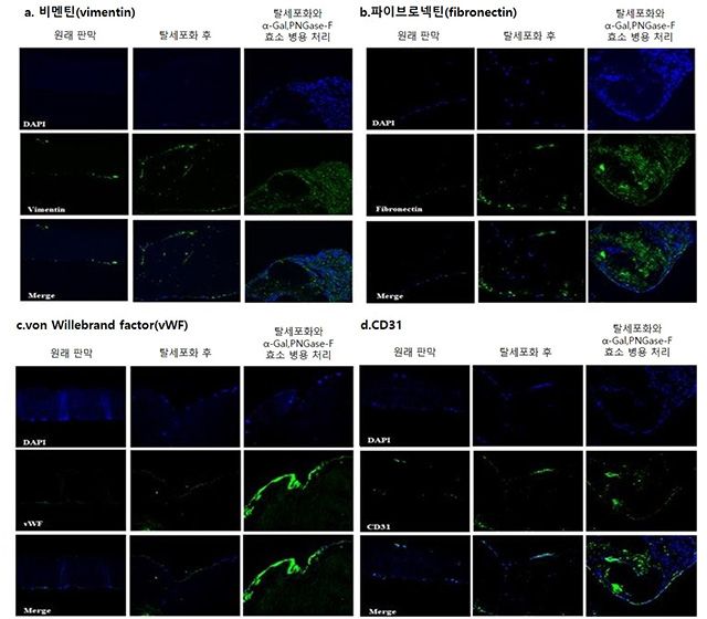 α-갈락토시다아제(α-Gal)와 PNGase-F로 처리한 이종조직판막에 사람 줄기세포와 제대정맥 내피세포를 공배양했을 때, Vimentin(a), Fibronectin(b), vWF(c), CD31(d) 발현이 모두 증가해 재세포화가 촉진된 모습(초록색 발현량 증가) /이미지 제공=서울대병원