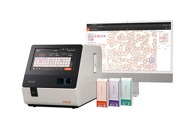 노을의 AI 기반 혈액·암 진단 플랫폼 ‘마이랩(miLab)’ 디바이스와 카트리지. /사진 제공=노을