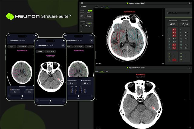 Heuron CTS /이미지 제공=휴런