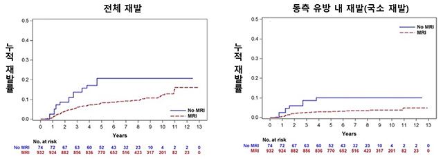 호르몬 수용체 음성 유방암 환자의 누적 재발률. MRI군(붉은 점선)은 비MRI군(파란 실선) 대비 전체 재발률(좌)과 동측 유방 내 재발률(우)이 모두 낮게 나타났다. /이미지 제공=서울대병원
