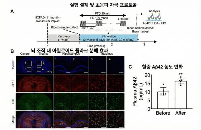 저강도 집속초음파를 적용한 알츠하이머병 쥐 모델에서 뇌 조직 내 아밀로이드 플라크 감소(좌)와 혈중 Aβ42 농도 증가(우)가 관찰됐다. /이미지 제공=한림대학교동탄성심병원