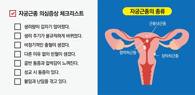 이미지 제공=순천향대 부천병원