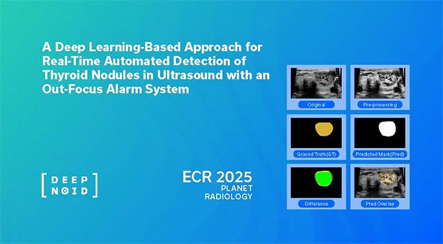 이미지 제공=딥노이드