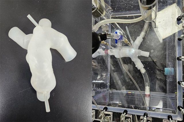 (왼쪽부터) 환자 맞춤형 우심실 유출로와 폐동맥 모델, 박동성 체외 모의 순환 기술 /사진 제공=서울대병원