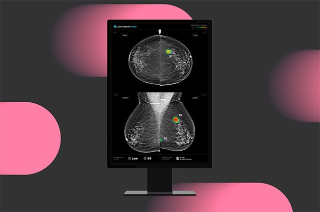 루닛 인사이트 MMG /이미지 제공=루닛