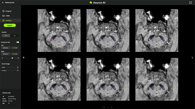 이미지 제공=휴런