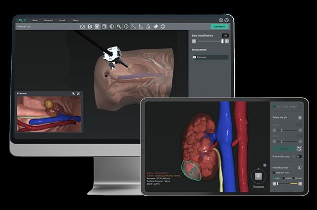RUS NE(Kidney) 3D 입체 가장 화면 /이미지 제공=휴톰