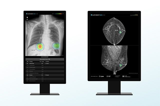 (왼쪽부터)Lunit INSIGHT CXR, Lunit INSIGHT MMG /이미지 제공=루닛