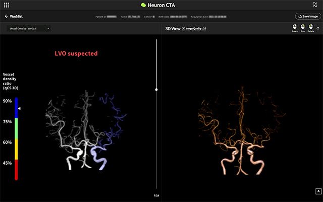 휴런CTA /이미지 제공=휴런