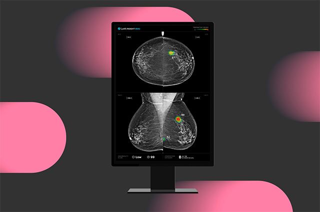 유방촬영술 AI 영상분석 솔루션 ‘루닛 인사이트 MMG’ /이미지 제공=루닛