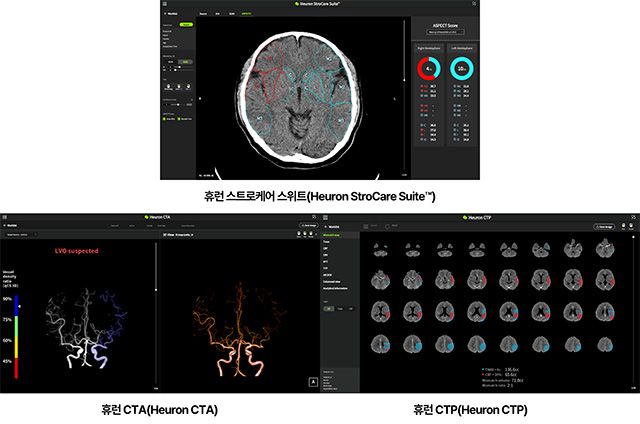 이미지 제공=휴런