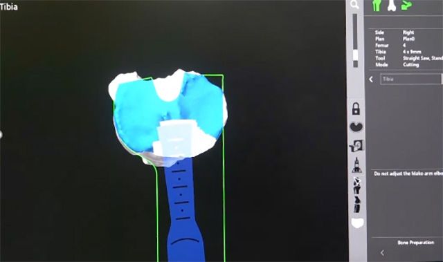 이미지 제공=한림대학교강남성심병원