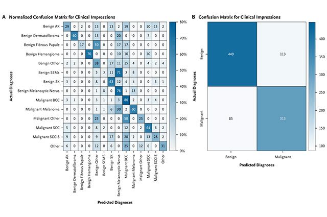 MIDAS 데이터셋을 기반으로 한 임상 진단의 혼동 행렬(confusion matrix). 피부암 진단에서 실제 결과와 예측 간의 불일치를 시각화한 자료로, AI 성능 검증의 필요성을 보여준다. /이미지 출처=NEJM AI