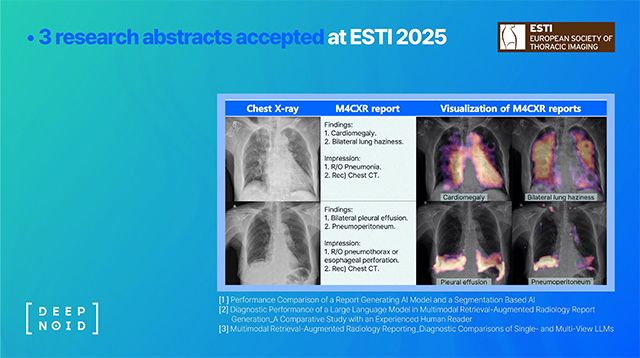 M4CXR 리포트 생성 예시 /이미지 제공=딥노이드