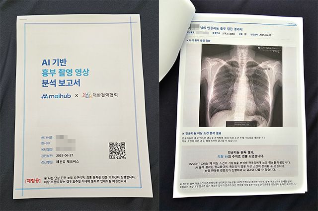 AI가 분석한 흉부 엑스레이 결과 보고서. 검진 당일 5분 내로 발급되며, 별도 전문의 판독 결과는 일주일 내 SMS로 제공된다.