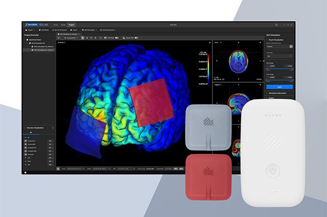 개인 맞춤형 tDCS 솔루션 이미지 /제공=뉴로핏