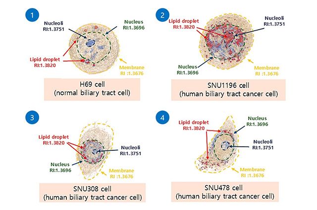 담관암 세포와 정상세포의 3D ODT 영상이미지 차이: 1번 정상세포와 비교해 2~4번 담관암 세포는 지질 방울(Lipid Droplet, 붉은색)이 밀집되고 불균일한 분포를 보인다. /이미지 제공=한림대학교동탄성심병원 