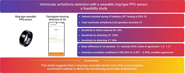 반지형 PPG 기반 웨어러블 기기를 활용한 심실 부정맥(VA) 감지 임상 연구 요약. CART-Ⅰ 기기를 착용한 25명 환자 대상으로 총 67건의 유도된 심실 부정맥 사례 분석 결과, 감도는 94%, 심실세동(VF) 감지 민감도는 100%로 나타났다. 심실빈맥(VT)은 90% 감지됐으며, 기준 심전도와 평균 0.1초의 오차범위 내에서 혈류 정지 감지 시점이 일치했다. /이미지 제공=스카이랩스