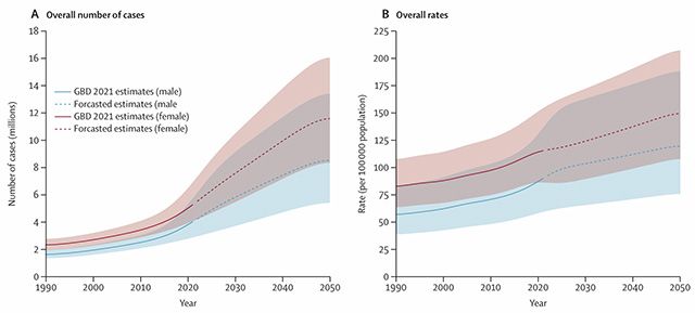 전 세계 황반변성 환자 수 및 유병률 예측 추이 (1990~2050). 남녀 모두 유병률 및 환자 수 증가가 예상되며, 특히 여성의 증가 폭이 더 클 것으로 예측됐다. /그래프 제공=경희대학교