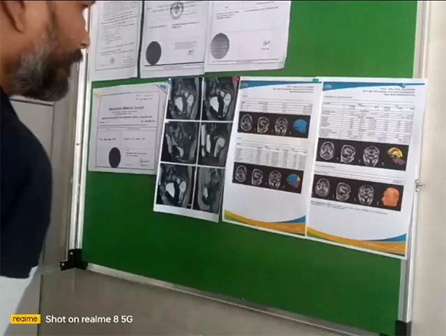 인도 자이더스 병원 의료진이 뇌 질환 분석 리포트를 검토하고 있는 모습. 해당 리포트는 뉴로맥스(NeurOmx)가 자동 생성한 결과로, 의료진의 진료 판단에 참고 자료로 활용된다. /사진 제공=피맥스