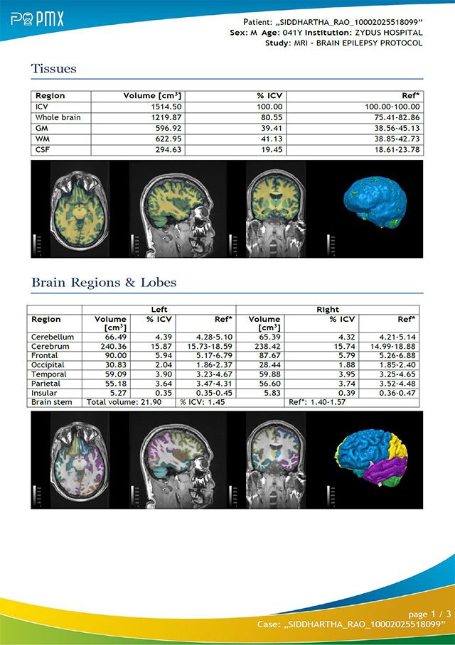 뉴로맥스(NeurOmx)가 생성한 뇌 MRI 분석 리포트 예시. 뇌 구조 및 부피 분석 결과를 시각화해 주요 이상 소견을 자동 도출하며, 병원 EMR 및 PACS 시스템과 연동해 제공된다. /이미지 제공=피맥스