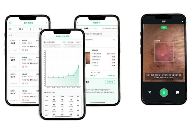 상처 영상분석 소프트웨어 ‘스키넥스 욕창(SkinEX_AI_Pulcer)’ /이미지 제공=파인헬스케어