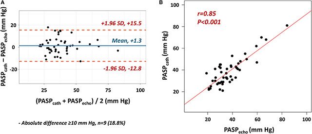 심초음파와 심도자술 간 폐동맥수축기압(PASP) 비교. 왼쪽(A) 그래프는 두 검사(PASP_echo, PASP_cath) 간 수축기압 차이를 나타낸 것으로, 평균 차이는 +1.3mmHg로 대부분의 수치가 ±15mmHg 범위에 분포했다. 오른쪽(B) 그래프는 두 검사 결과 간 높은 상관관계(r=0.85)를 보여준다. 이는 심초음파만으로도 침습적 검사 수준의 정확한 진단이 가능하다는 점을 시사한다. /출처=Journal of the American Heart Association, 2025년 14권 (doi:10.1161/JAHA.125.041981)