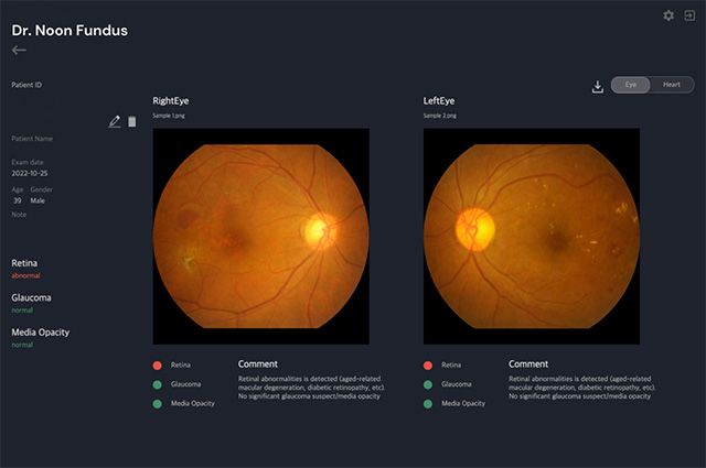 안질환 진단보조 AI 솔루션 ‘닥터눈 펀더스’화면 예시 /이미지 제공=메디웨일