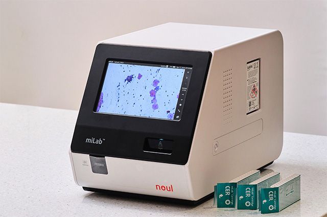 AI 기반 자궁경부암 진단 플랫폼 miLab CER /사진 제공=노을