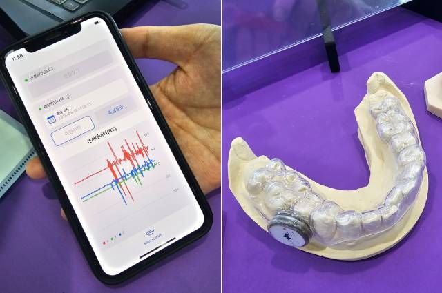 이갈이 진단 기기. 치아 보호대에 부착한 센서가 수면 중 압력·진동을 측정한다.