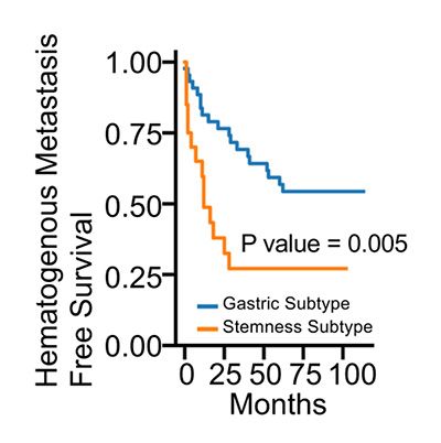 혈행성 전이 무재발 생존곡선(HMFS): 줄기세포성 아형 환자는 위 점막형 아형 환자보다 혈행성 전이가 더 빨리 발생했다. /이미지 제공=서울대병원