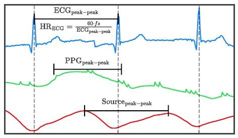 심전도(파란색), 광용적맥파 원 신호(초록색), 인공지능으로 분리된 근원 신호(빨간색) 비교 그래프. 분리된 근원 신호에서는 심전도 기준 심장 박동 시점과 일치하는 피크가 뚜렷하게 나타난다. /이미지 제공=서울대병원